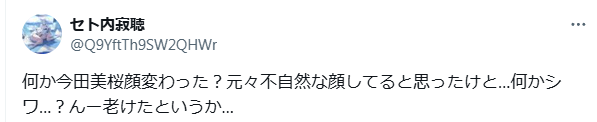 今田美桜　顔変わった　整形