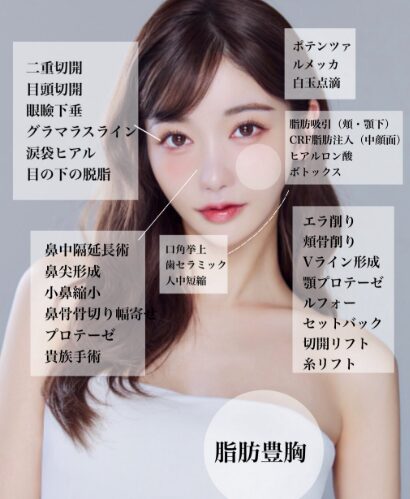 Rちゃん 整形前 昔の顔