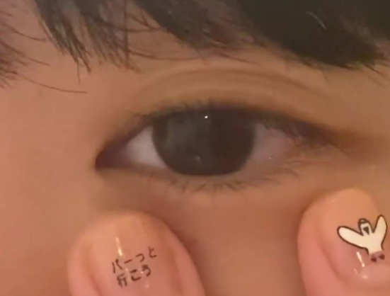 あいみょん　目頭切開