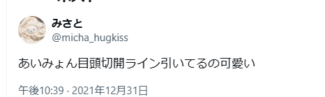 あいみょん　目頭切開