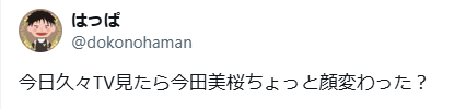 今田美桜　顔変わった　整形