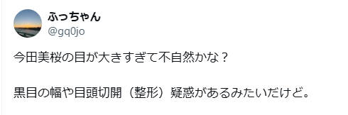 今田美桜　顔変わった　整形