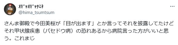 今田美桜　顔変わった　整形
