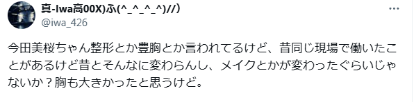 今田美桜　顔変わった　整形