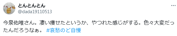 今泉佑唯 顔変わった 整形