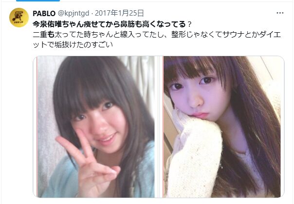 今泉佑唯 顔変わった 整形