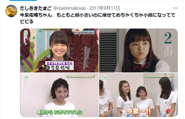 今泉佑唯 顔変わった 整形