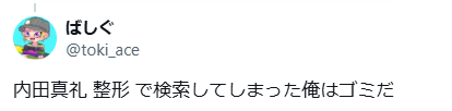 内田真礼　顔変わった　整形