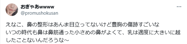えなこ　顔変わった　整形