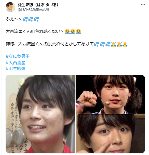 大西流星　顔変わった　整形