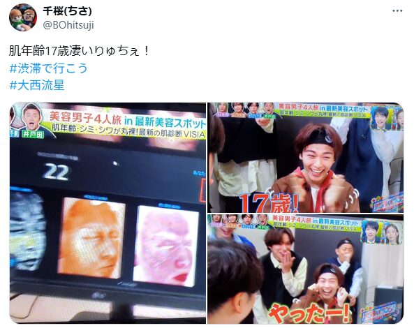 大西流星　顔変わった　整形