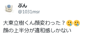 大東立樹　顔変わった　整形