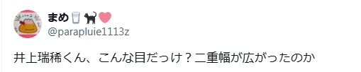 井上瑞稀　顔変わった　整形
