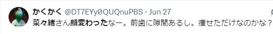 奈々緒 整形 顔変わった