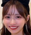 にじほ 整形 顔変わった