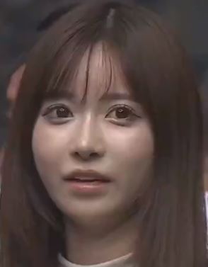 にじほ 整形 顔変わった
