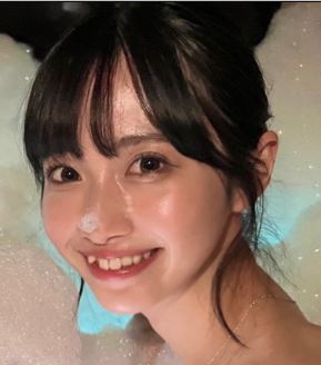にじほ 整形 顔変わった