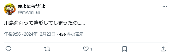 川島海荷　整形　顔変わった