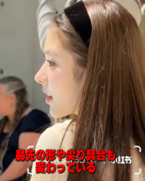 MEOVV田中杏奈　顔変わった　整形