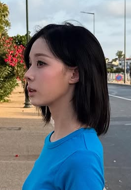 ウィンター　整形　顔変わった