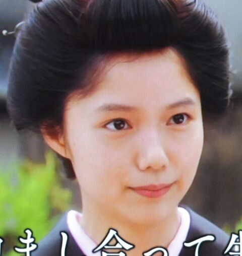宮崎あおい　顔変わった　整形