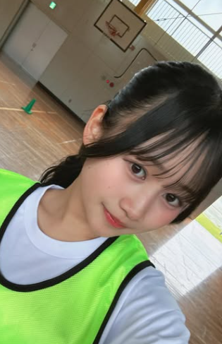 伊藤彩華　顔変わった　整形