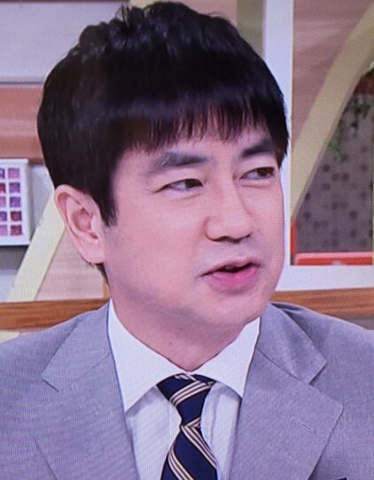 羽鳥慎一　整形　顔変わった