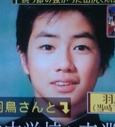 羽鳥慎一　整形　顔変わった
