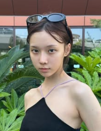 ウィンター　整形　顔変わった