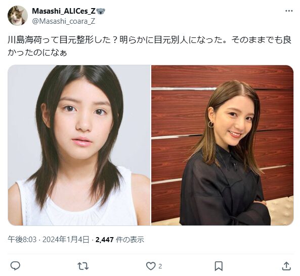 川島海荷　整形　顔変わった