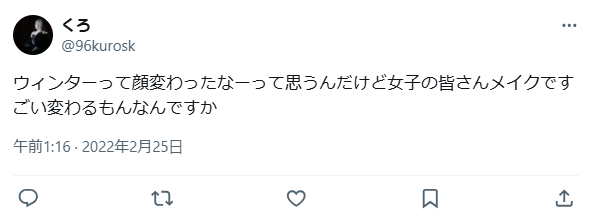 ウィンター　整形　顔変わった
