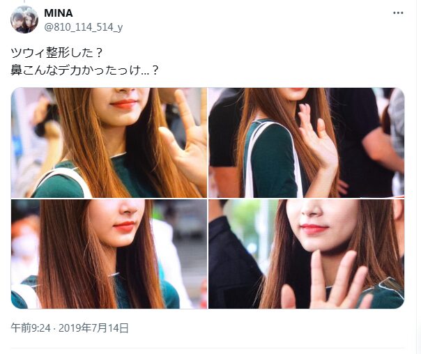 ツウィ　整形　顔変わった