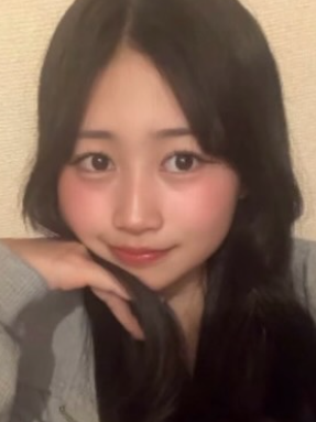 伊藤彩華　顔変わった　整形