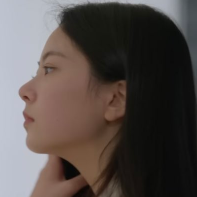 ウンチェ　整形　顔変わった