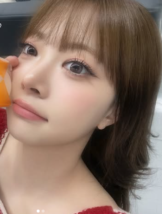 ウンチェ　整形　顔変わった