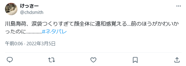 川島海荷　整形　顔変わった