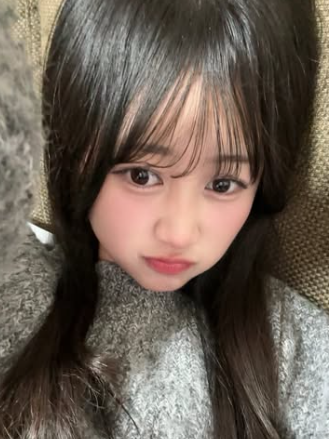 伊藤彩華　顔変わった　整形
