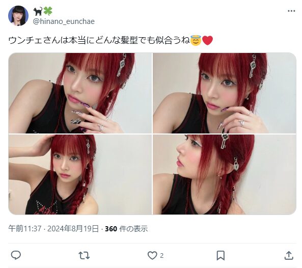 ウンチェ　整形　顔変わった