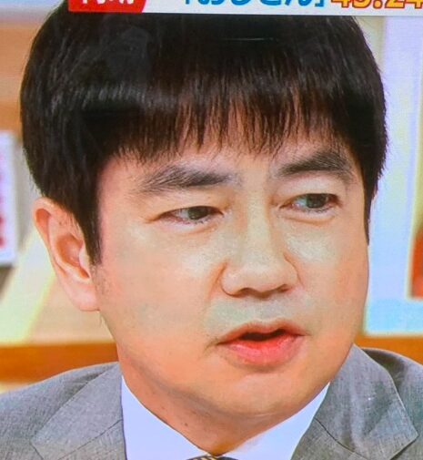 羽鳥慎一　整形　顔変わった
