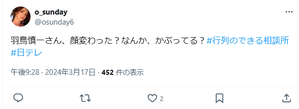 羽鳥慎一 整形 顔変わった 羽鳥慎一 整形 顔変わった