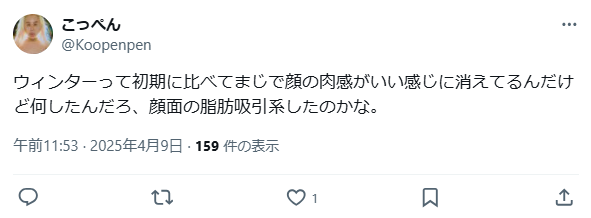 ウィンター　整形　顔変わった