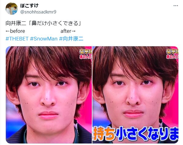 向井康二　顔変わった　整形