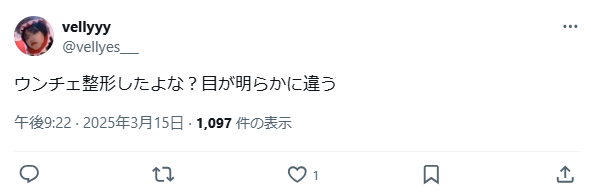ウンチェ　整形　顔変わった