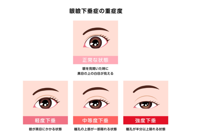 羽鳥慎一　整形　顔変わった