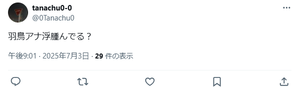 羽鳥慎一　整形　顔変わった