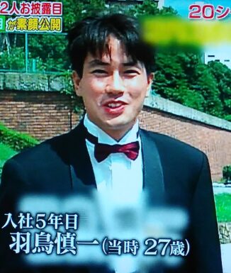 羽鳥慎一　整形　顔変わった