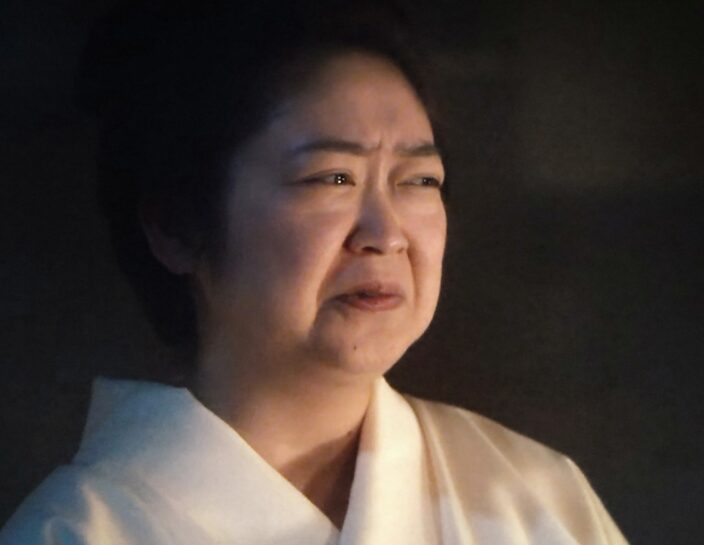池脇千鶴　整形　顔変わった