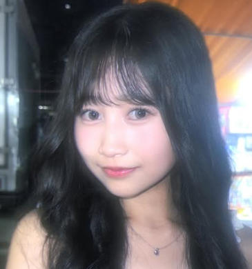 伊藤彩華　顔変わった　整形