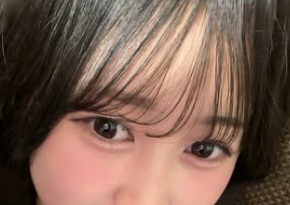 伊藤彩華　顔変わった　整形