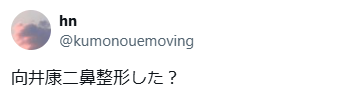 向井康二　顔変わった　整形
